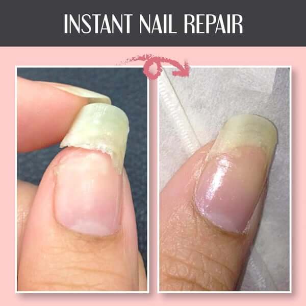 50% OFF | NailRevive™ Nail Repair Gel